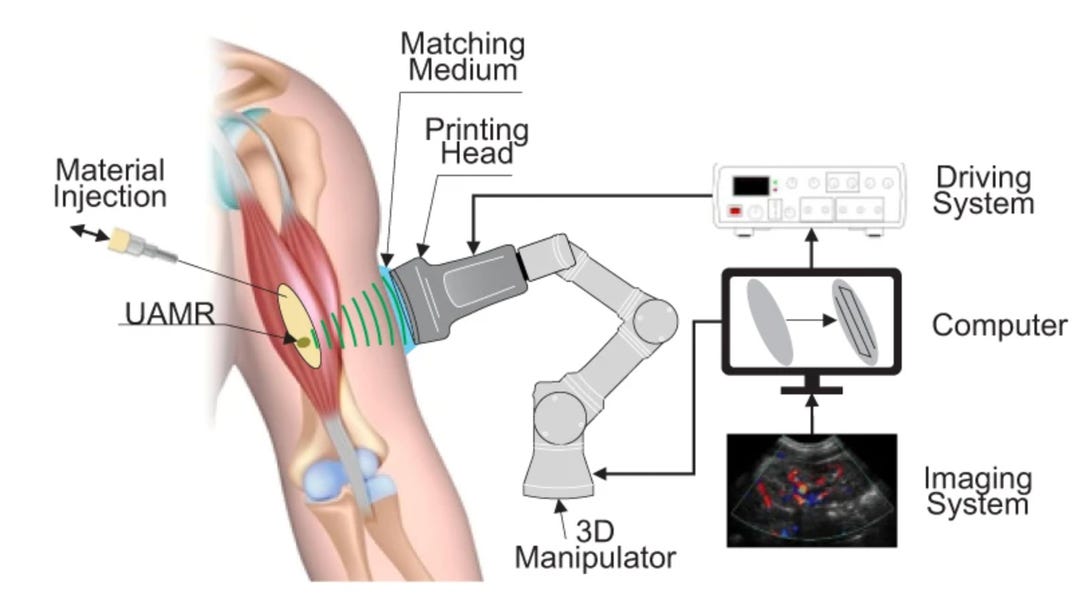 Graphic showing the setup for 3D printing inside an arm